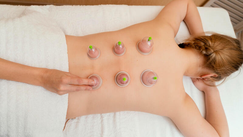 best cupping therapy in Mississauga